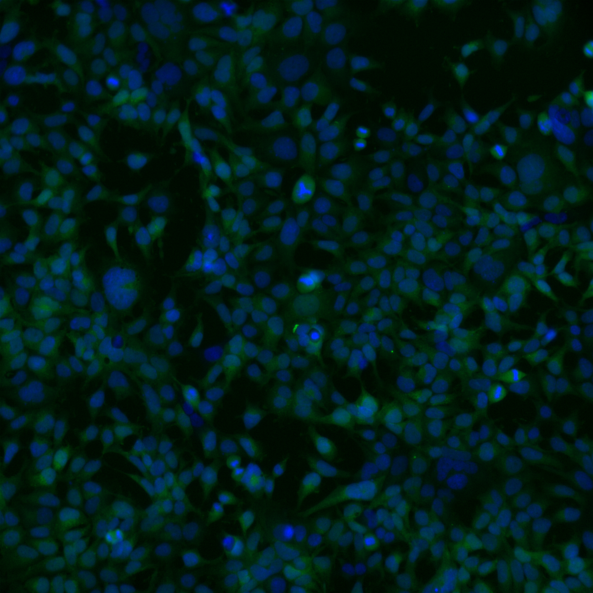 Fluorescence imaging of live cells used in LIPS screening